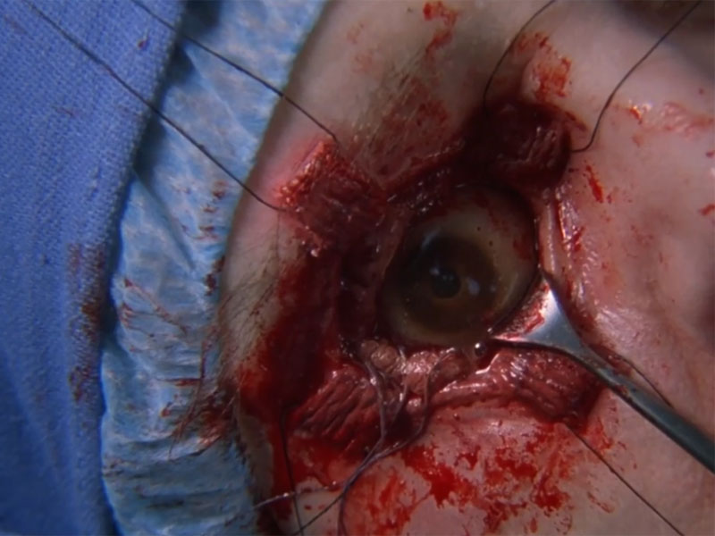 The Eye